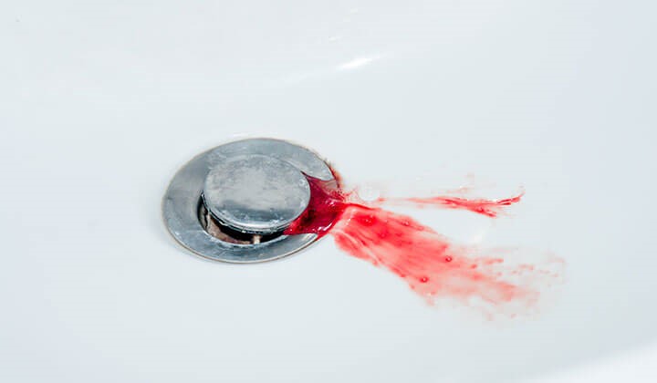 Waschbecken mit Blut Zahnfleischbluten kann verschiedene Ursachen haben